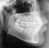 Radiologia Odontológica em Igarassu